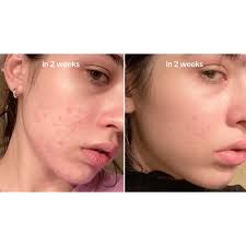سرم ضد لک و شفاف کننده نیاسینامید آنوا | Anua niacinamide serum volume 30 mil - تصویر 3