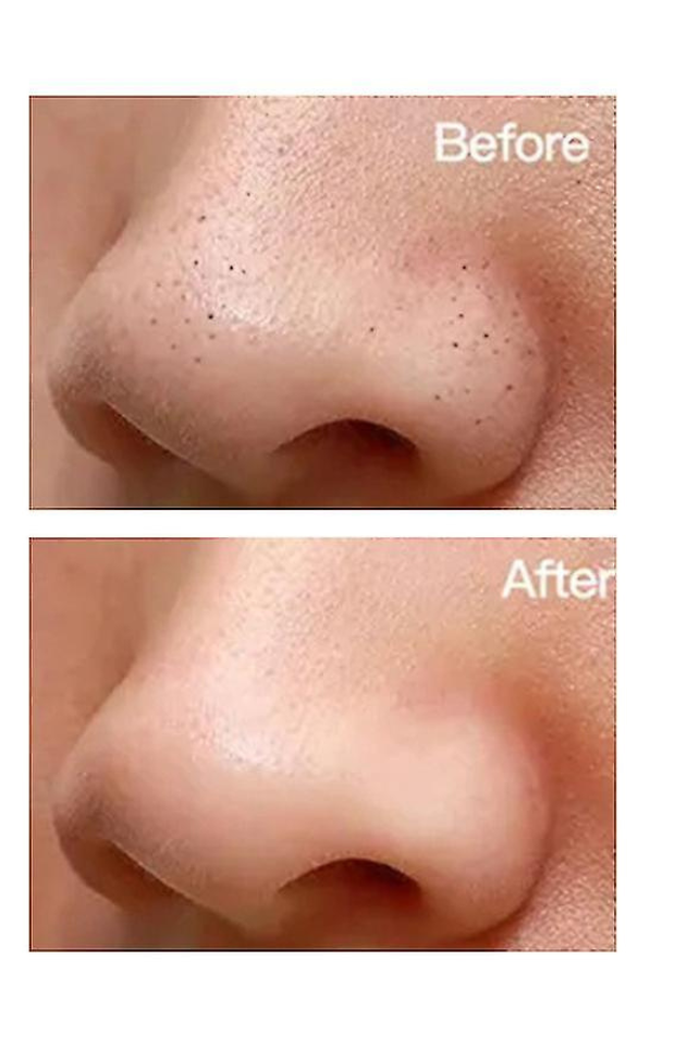 تونر لایه بردار گلیکولیک اسید اوردینری 240 میل - تصویر 5